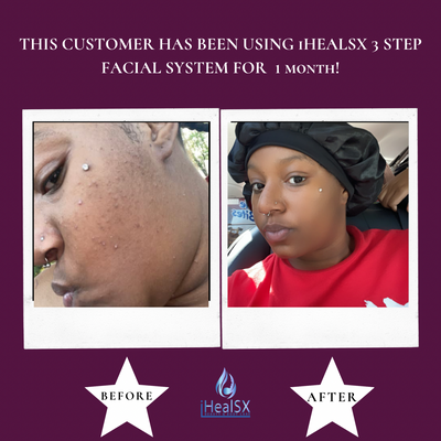 iHeal 3 Step Facial Cleansing System